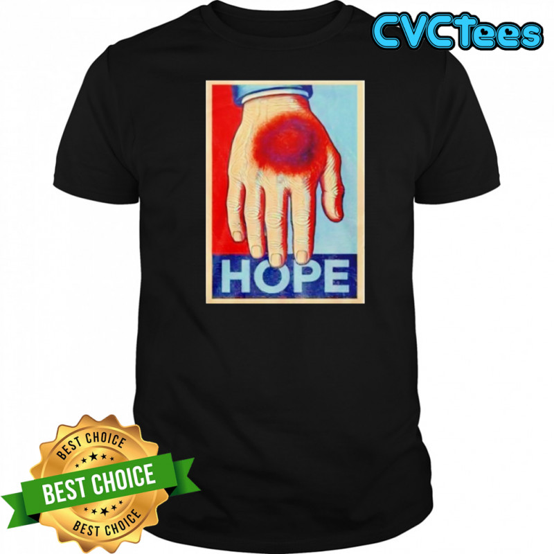 Donald Trump bruise hand hope shirt